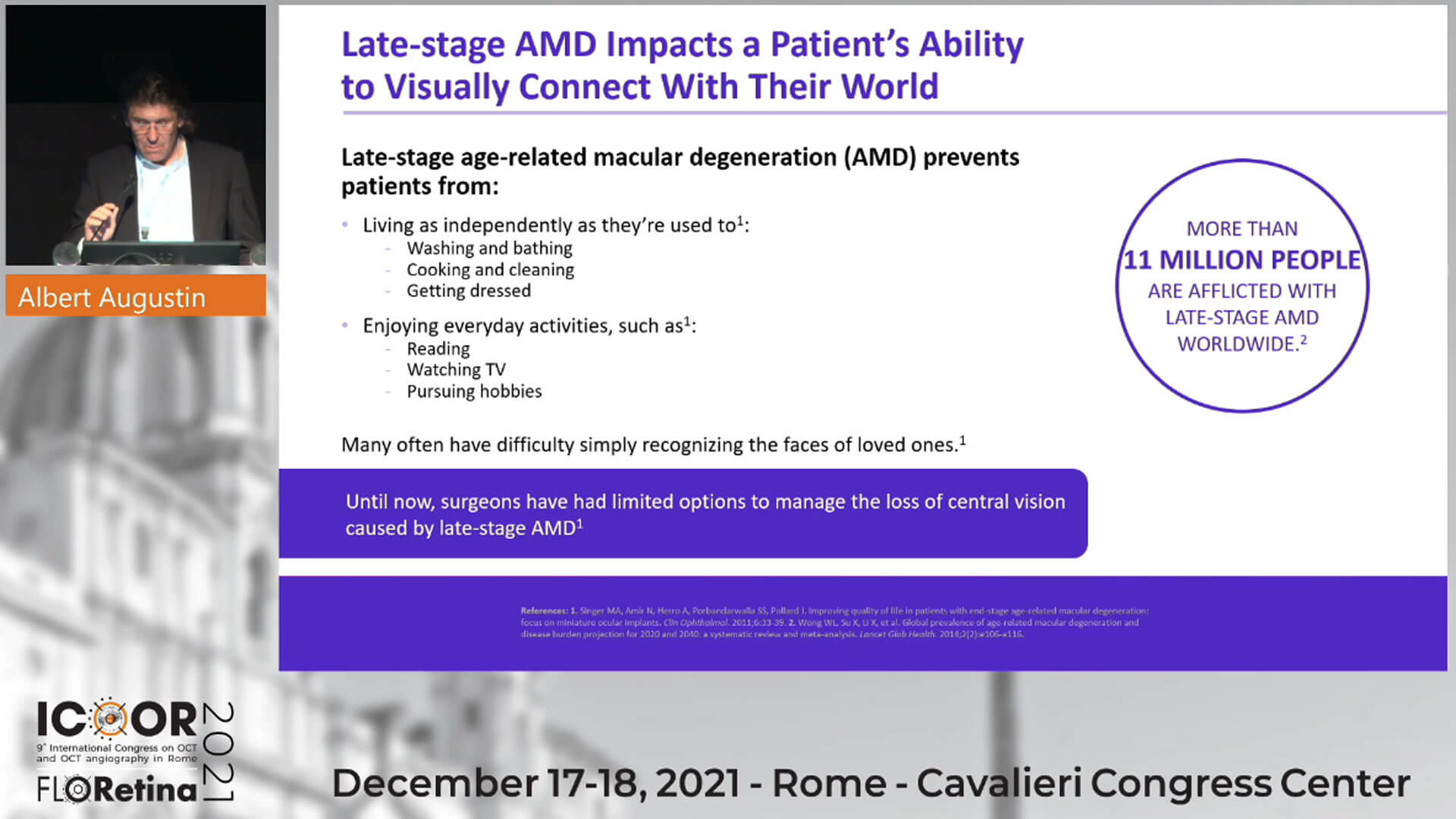 Samsara Vision’s Telescope Implant for Macular Degeneration