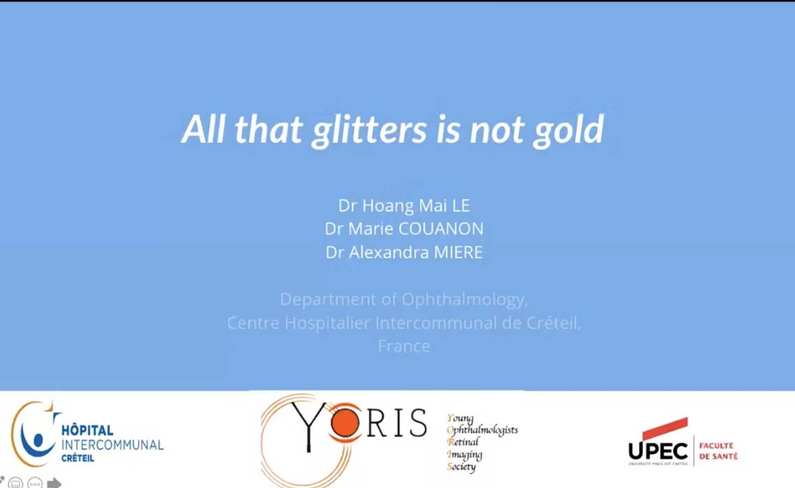 All that glitters is not gold