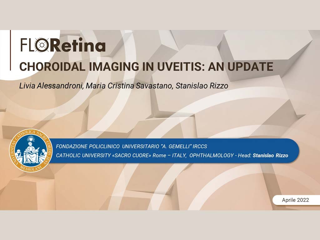 Choroidal imaging in uveitis: an update