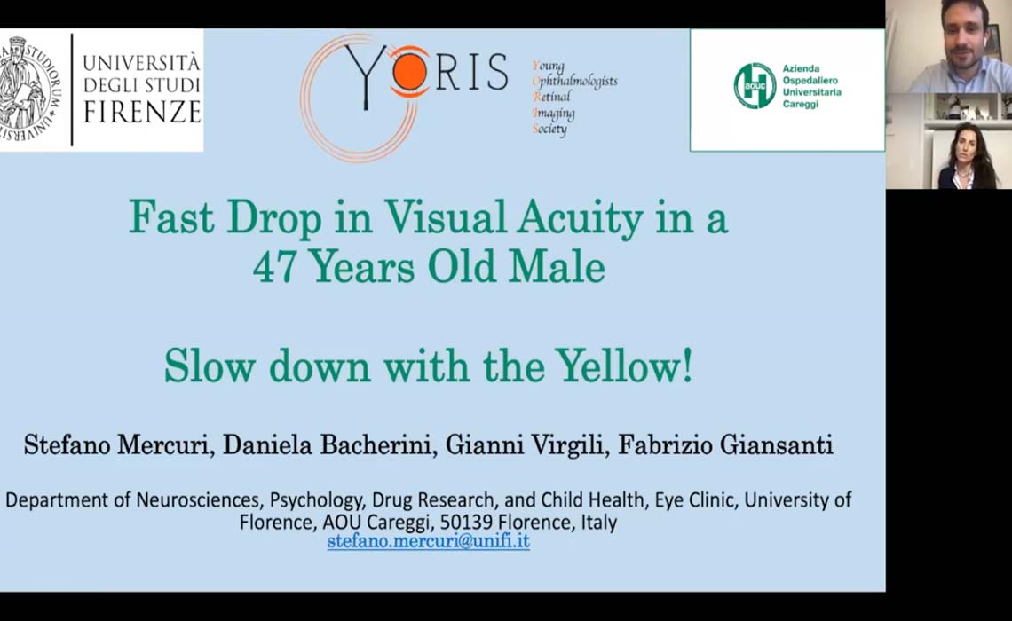 FAST DROP IN VISUAL ACUITY IN A 47 YEARS OLD MALE: SLOW DOWN WITH THE YELLOW!