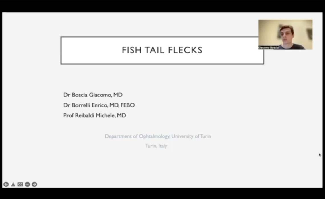 Fish Tail flecks