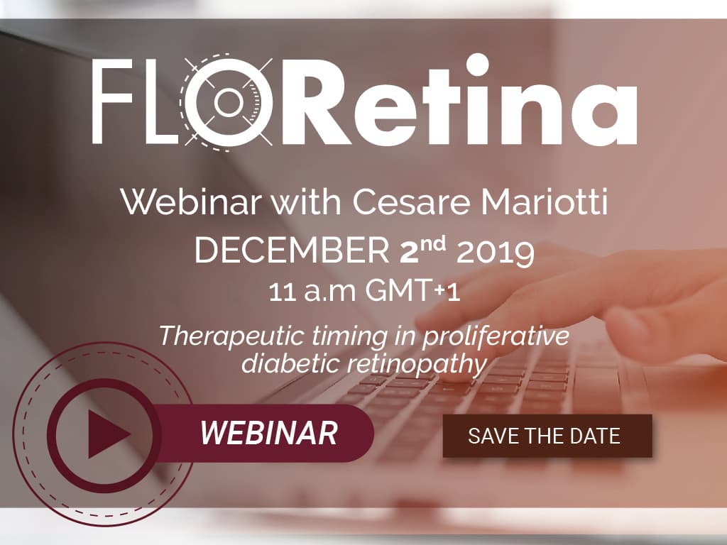 Therapeutic timing in proliferative diabetic retinopathy