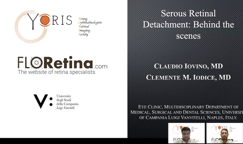 Serous retinal detachment: Behind the scenes