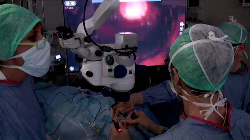 Tractional Retinal Detachment