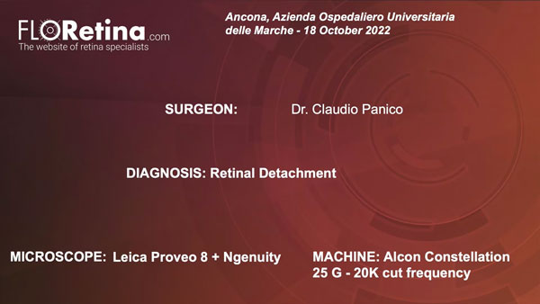 RETINAL DETACHMENT (Ancona, 18/10/22)