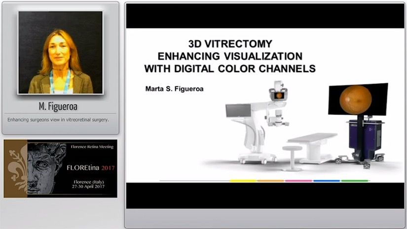 3D VITRECTOMY ENHANCING VISUALIZATION WITH DIGITAL COLOR CHANNELS